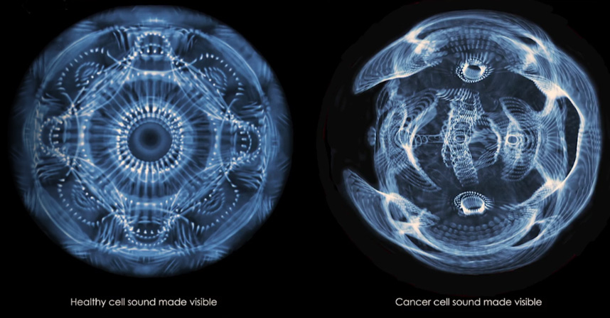 Cymatics - healthy vs. cancer cell
