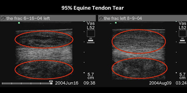 Cymatics - equine tendon tear